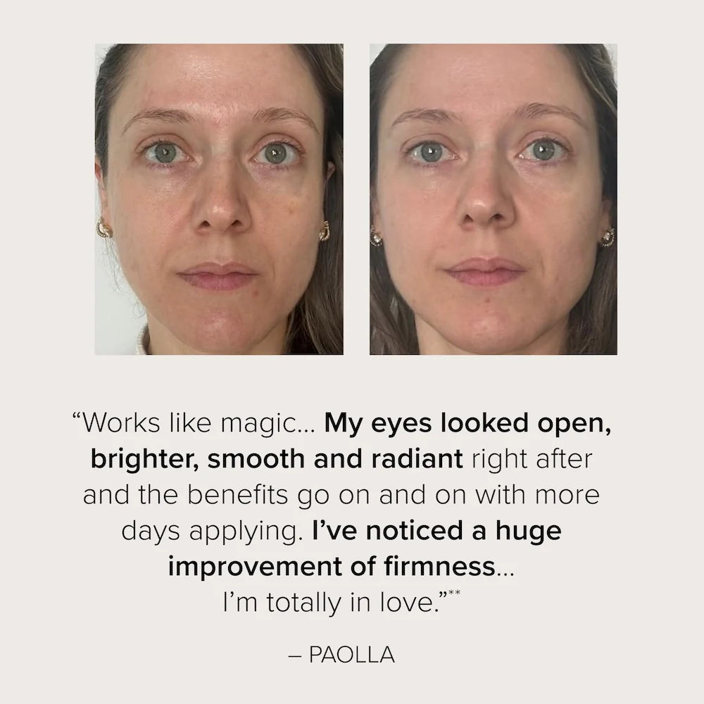 Dark Circle Eraser™ - Image 6