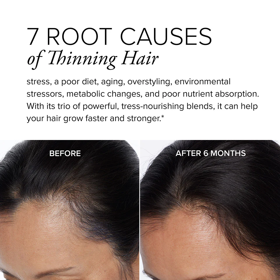 Hair Regeneres® ADVANCED - Image 4